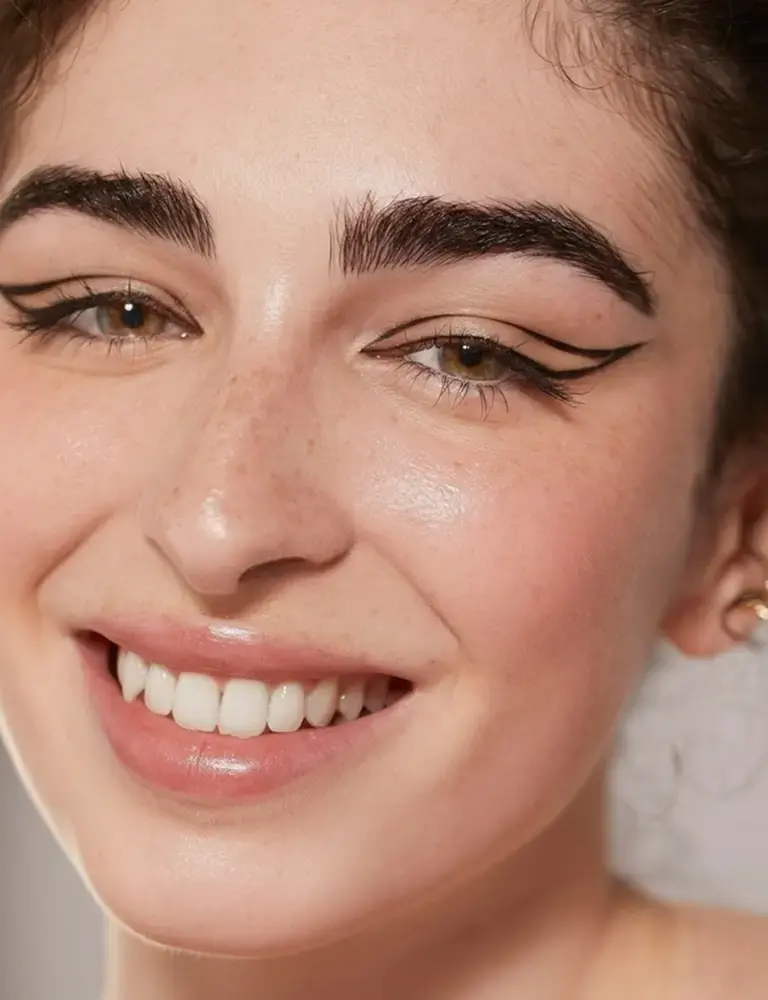 Улыбка пациента до и после лечения элайнерами FlexiLigner