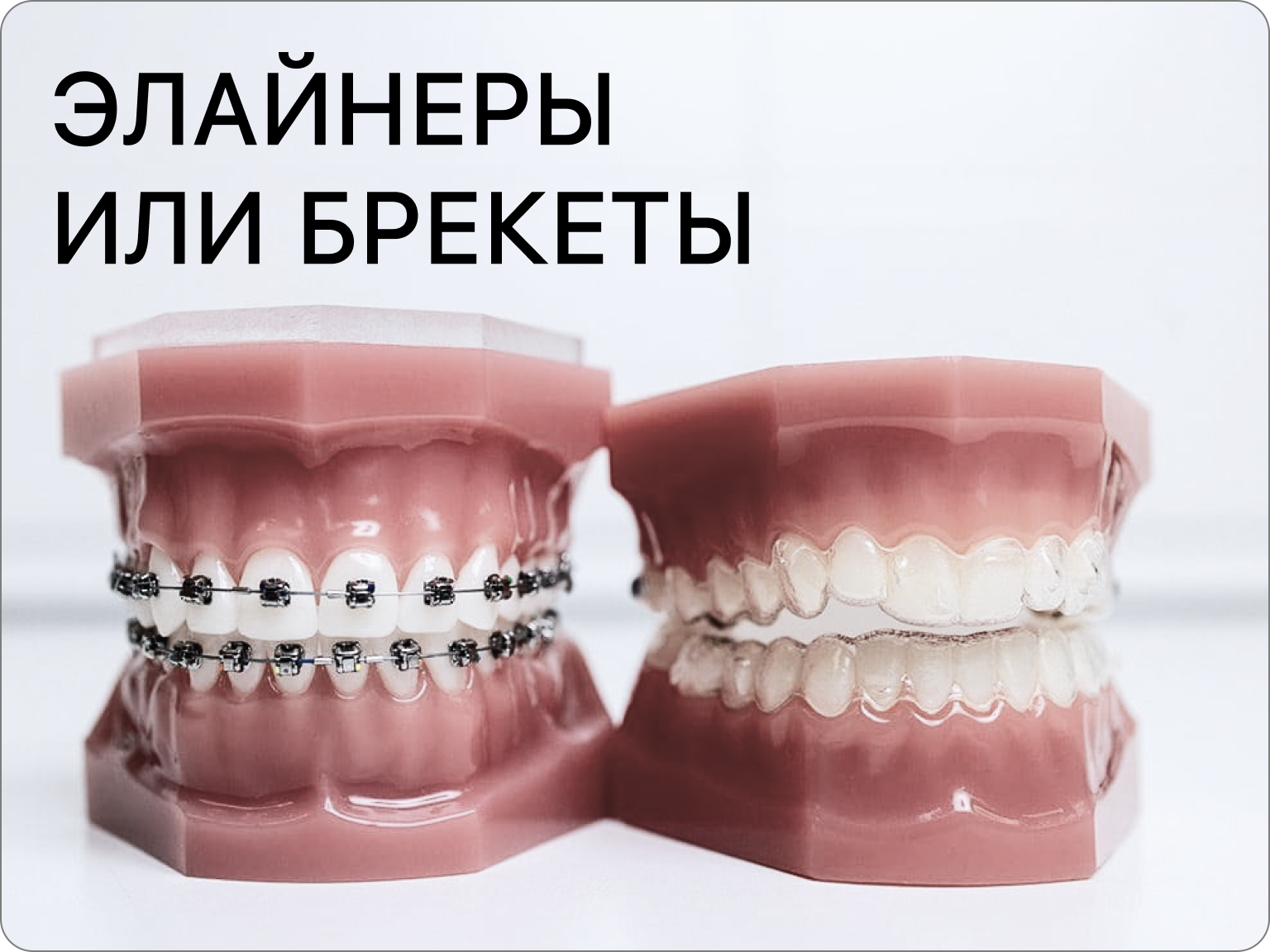 Выбор между элайнерами и брекетами