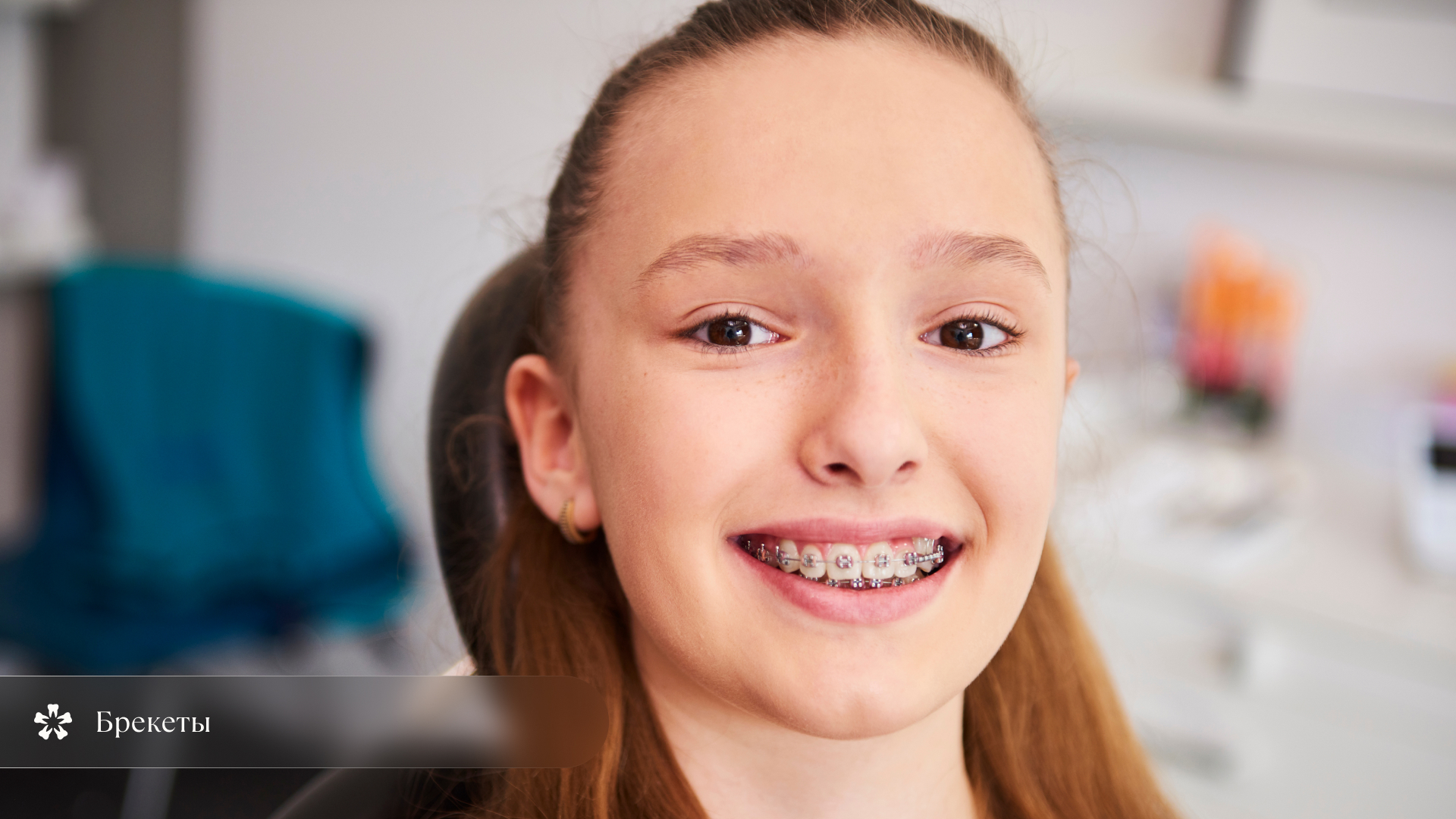 Брекеты 