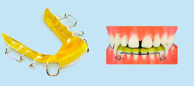 Аппарат Брюкля