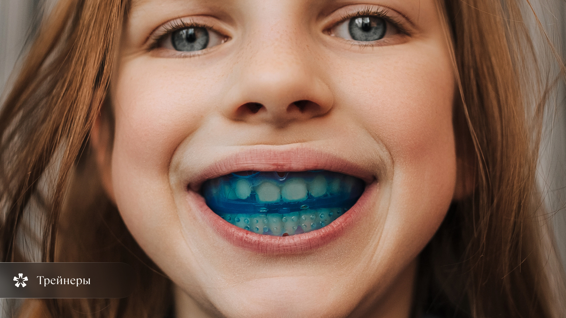 Ортодонтические трейнеры для исправления открытого прикуса у детей